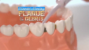 Oral Irrigator